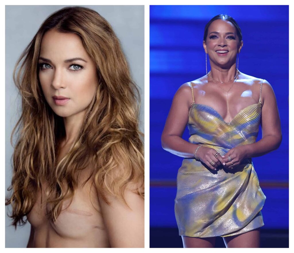 La imagen actual no tiene texto alternativo. El nombre del archivo es: adamari-lopez-muestra-la-cicatriz-que-le-dejo-el-cancer-de-mama-f5903836-1-scaled.jpg